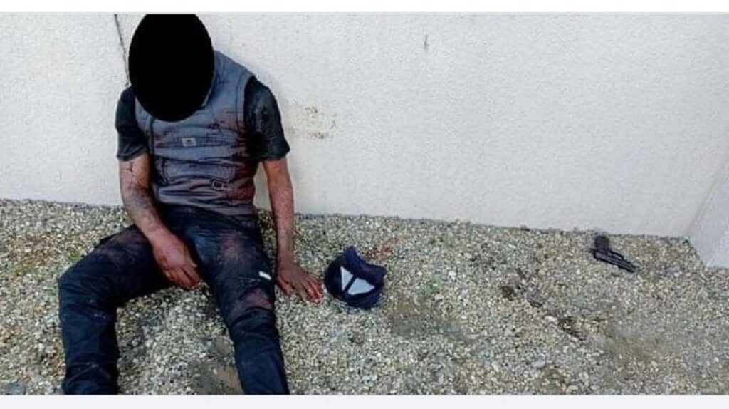 Car hijacker loses his Lower part during a shoot out with SAPS Officers